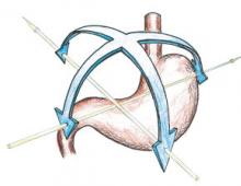 Acute expansion of the stomach and stomach breakdown in dogs