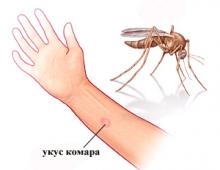 How and what to treat mosquito bites and other insects in children: drugs and proven folk recipes what to do when swelling if the child combed his rink