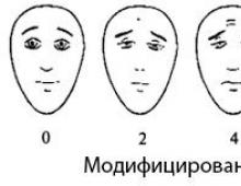 Visual analogue pain scale (VAS) Facial pain scale