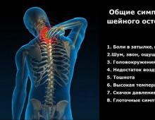 Treatment of osteochondrosis of the cervical spine Treatment of osteochondrosis of the cervical spine