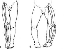 Methods for measuring limb length and joint range of motion